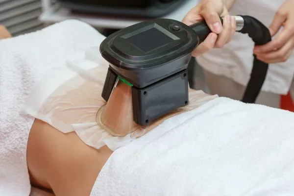 Image of person having fat freezing treatment to help weight gain Wolverhampton