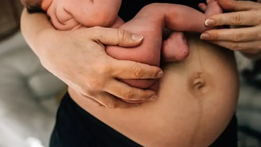 Why Is My Stomach Still Big After Pregnancy Wolverhampton?